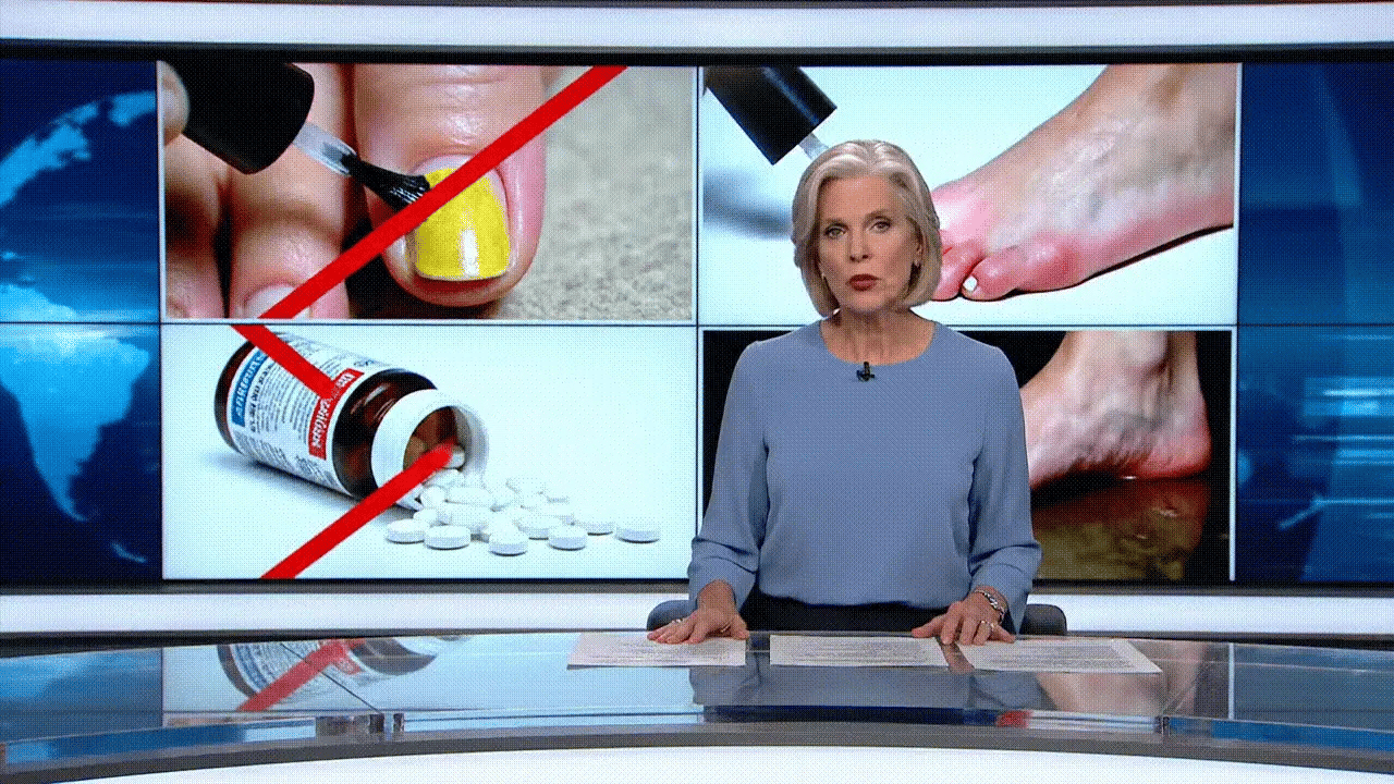 TV news report on nail fungus treatments Image