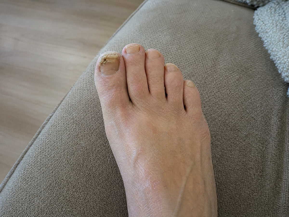 Close-up of a toenail Image